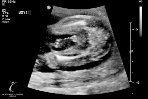 ultrasound 2014-12-10 01.jpg